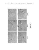 TRANSGENIC NON-HUMAN ANIMAL MODEL FOR ACCELERATED AGING AND/OR AGE-RELATED     SYMPTOM, AND USE THEREOF diagram and image