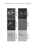 TRANSGENIC NON-HUMAN ANIMAL MODEL FOR ACCELERATED AGING AND/OR AGE-RELATED     SYMPTOM, AND USE THEREOF diagram and image