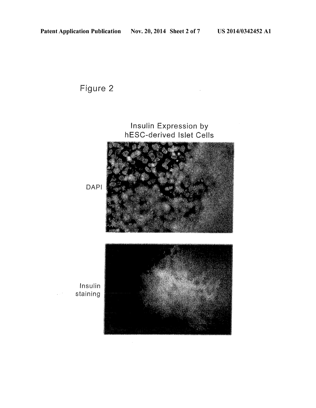 Islet Cells From Human Embryonic Stem Cells - diagram, schematic, and image 03