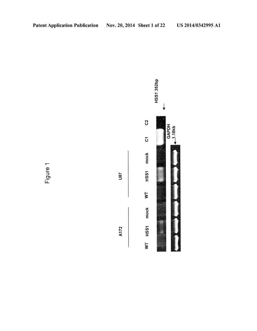 METHOD FOR TREATING BRAIN CANCER USING A NOVEL TUMOR SUPPRESSOR GENE AND     SECRETED FACTOR - diagram, schematic, and image 02