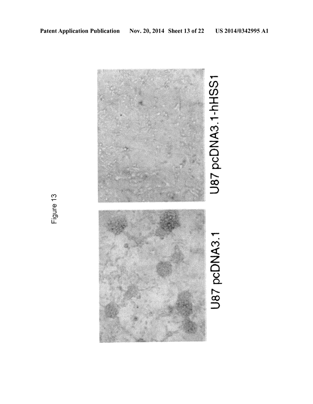 METHOD FOR TREATING BRAIN CANCER USING A NOVEL TUMOR SUPPRESSOR GENE AND     SECRETED FACTOR - diagram, schematic, and image 14