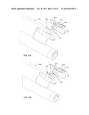 SECONDARY IMAGING ENDOSCOPIC DEVICE diagram and image