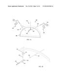 RAPID LAPAROSCOPY EXCHANGE SYSTEM AND METHOD OF USE THEREOF diagram and image