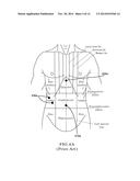 RAPID LAPAROSCOPY EXCHANGE SYSTEM AND METHOD OF USE THEREOF diagram and image