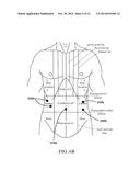 RAPID LAPAROSCOPY EXCHANGE SYSTEM AND METHOD OF USE THEREOF diagram and image