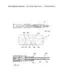 RAPID LAPAROSCOPY EXCHANGE SYSTEM AND METHOD OF USE THEREOF diagram and image