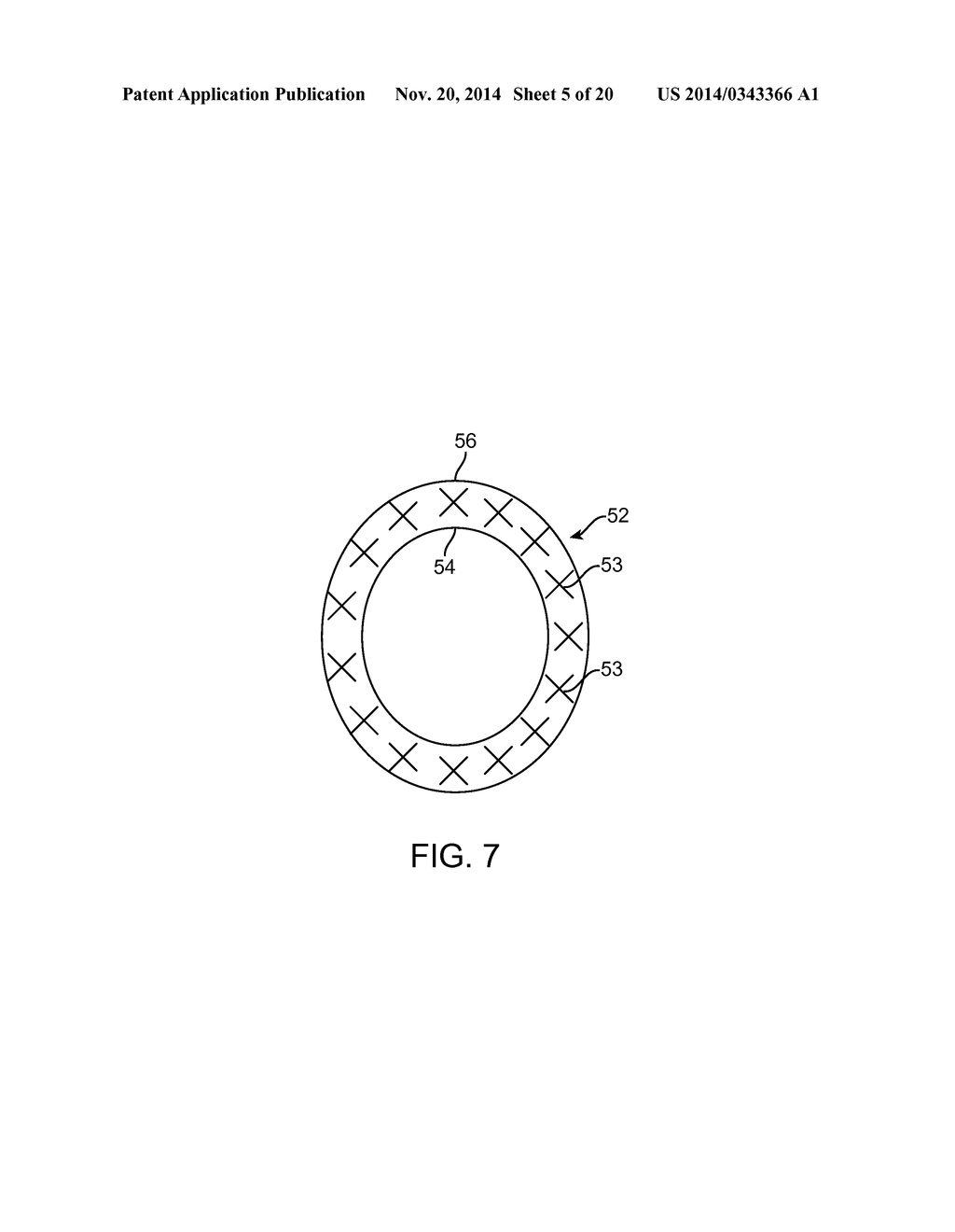 METHODS AND APPARATUS FOR REDUCING THE RISK OF SURGICAL SITE INFECTIONS - diagram, schematic, and image 06