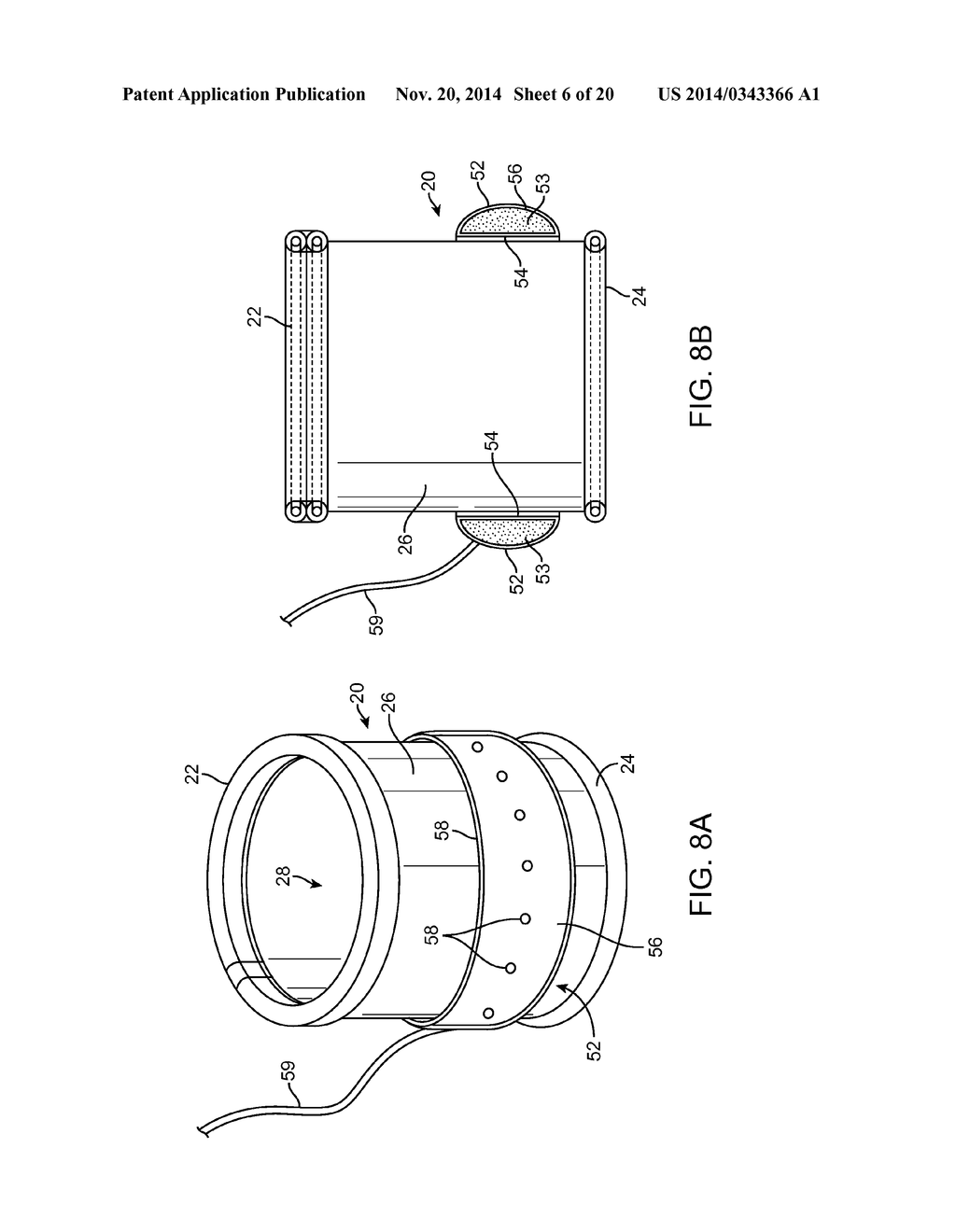 METHODS AND APPARATUS FOR REDUCING THE RISK OF SURGICAL SITE INFECTIONS - diagram, schematic, and image 07