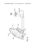 METHOD AND APPARATUS FOR PROVIDING DERVIED GLUCOSE INFORMATION UTILIZING     PHYSIOLOGICAL AND/OR CONTEXTUAL PARAMETERS diagram and image