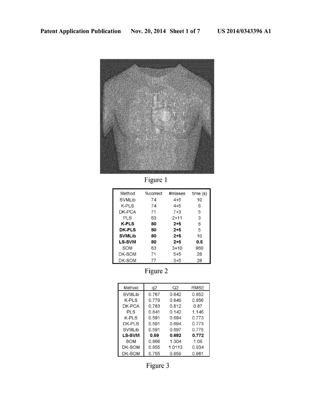 Use of Machine Learning for Classification of Magneto Cardiograms - diagram, schematic, and image 02