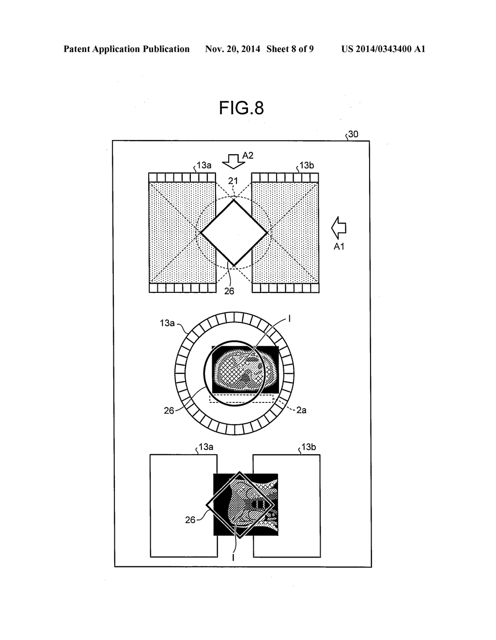 MEDICAL IMAGE DIAGNOSIS APPARATUS AND PET-MRI APPARATUS - diagram, schematic, and image 09