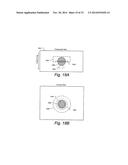 Reduced Image Reading Time and Improved Patient Flow in Automated Breast     Ultrasound Using Enchanced, Whole Breast Navigator Overview Images diagram and image