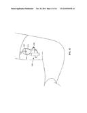 Visible Light Photo-Disinfection Patch diagram and image