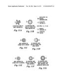 ADVANCED METHODS AND SYSTEMS FOR TREATING CELL PROLIFERATION DISORDERS diagram and image