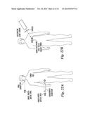 ADVANCED METHODS AND SYSTEMS FOR TREATING CELL PROLIFERATION DISORDERS diagram and image