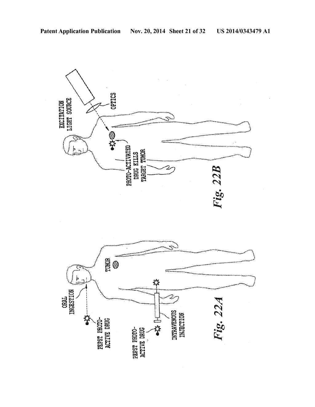 ADVANCED METHODS AND SYSTEMS FOR TREATING CELL PROLIFERATION DISORDERS - diagram, schematic, and image 22