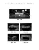 COMPOSITIONS WITH REACTIVE INGREDIENTS, AND WOUND DRESSINGS, APPARATUSES,     AND METHODS diagram and image