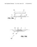 WOUND CARE DEVICE FOR TREATING WOUNDS BY MEANS OF SUBATMOSPHERIC PRESSURE diagram and image