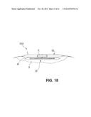 WOUND CARE DEVICE FOR TREATING WOUNDS BY MEANS OF SUBATMOSPHERIC PRESSURE diagram and image