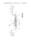 WOUND CARE DEVICE FOR TREATING WOUNDS BY MEANS OF SUBATMOSPHERIC PRESSURE diagram and image