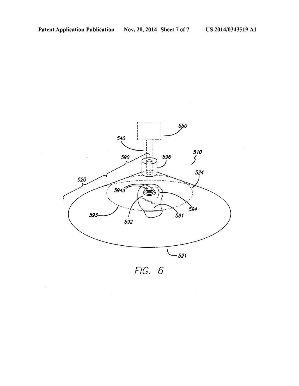 FLEXIBLE REDUCED PRESSURE TREATMENT APPLIANCE - diagram, schematic, and image 08