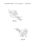 LASER FIDUCIALS FOR AXIS ALIGNMENT IN CATARACT SURGERY diagram and image