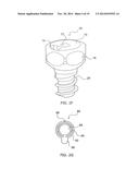 BONE SCREW SYSTEM AND METHOD diagram and image