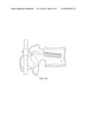 BONE SCREW SYSTEM AND METHOD diagram and image