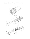 BONE SCREW SYSTEM AND METHOD diagram and image