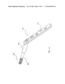 BONE SCREW SYSTEM AND METHOD diagram and image