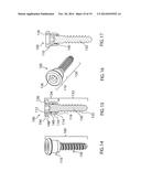 BONE SCREW SYSTEM AND METHOD diagram and image