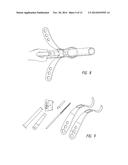 MINIMALLY INVASIVE OSTEOTOMY DEVICE WITH PROTECTION AND CUTTING GUIDE diagram and image