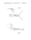 MINIMALLY INVASIVE OSTEOTOMY DEVICE WITH PROTECTION AND CUTTING GUIDE diagram and image