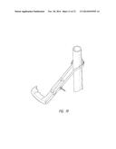 MINIMALLY INVASIVE OSTEOTOMY DEVICE WITH PROTECTION AND CUTTING GUIDE diagram and image