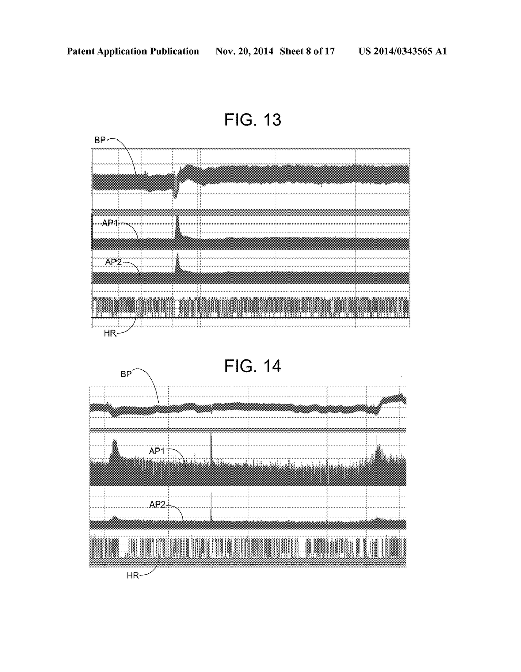 ELECTRICAL TREATMENT OF BRONCHIAL CONSTRICTION - diagram, schematic, and image 09