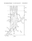 DEPLOYMENT TOOL FOR SUTURELESS VASCULAR ANASTOMOSIS CONNECTION diagram and image