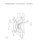 DEPLOYMENT TOOL FOR SUTURELESS VASCULAR ANASTOMOSIS CONNECTION diagram and image