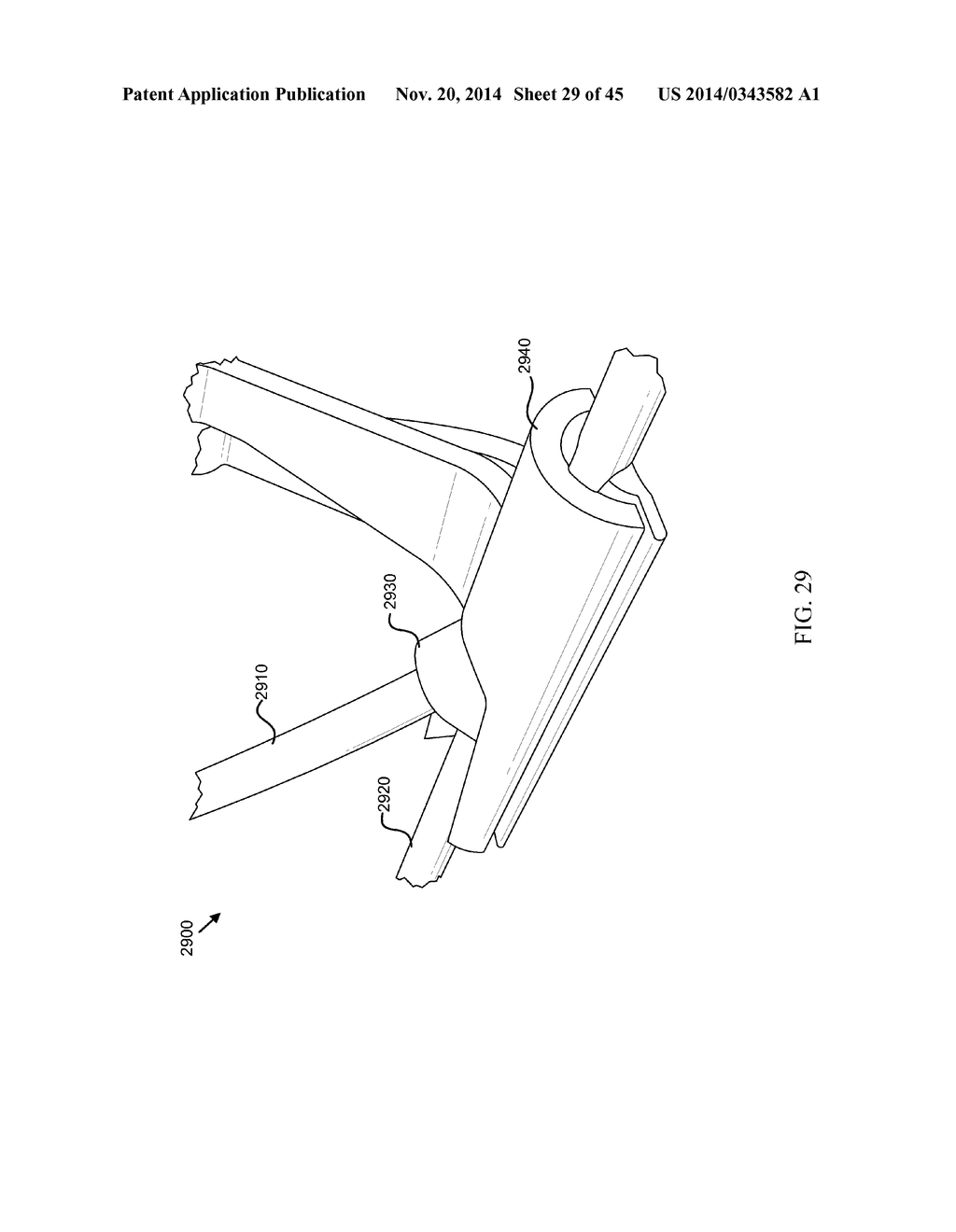 DEPLOYMENT TOOL FOR SUTURELESS VASCULAR ANASTOMOSIS CONNECTION - diagram, schematic, and image 30