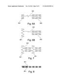 Device, And A Method For Treatment Of Increased Blood Pressure diagram and image