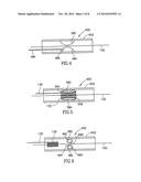 EMBOLISM FILTER WITH SELF-DEPLOYABLE GUIDEWIRE STOP diagram and image