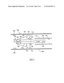 EMBOLISM FILTER WITH SELF-DEPLOYABLE GUIDEWIRE STOP diagram and image