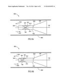 EMBOLISM FILTER WITH SELF-DEPLOYABLE GUIDEWIRE STOP diagram and image