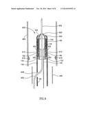 EMBOLISM FILTER WITH SELF-DEPLOYABLE GUIDEWIRE STOP diagram and image