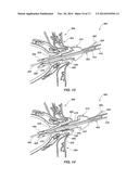 MEDICAL DEVICE FOR MODIFICATION OF LEFT ATRIAL APPENDAGE AND RELATED     SYSTEMS AND METHODS diagram and image