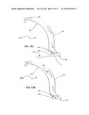 MEDICAL DEVICE FOR MODIFICATION OF LEFT ATRIAL APPENDAGE AND RELATED     SYSTEMS AND METHODS diagram and image