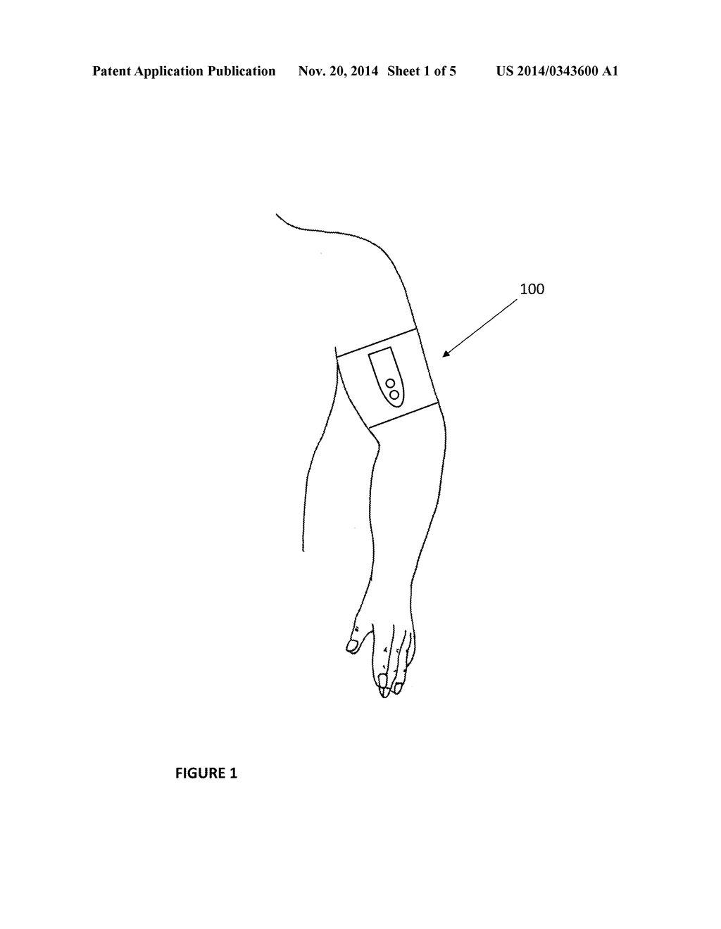 MULTI-MODE INFLATABLE LIMB OCCLUSION DEVICE - diagram, schematic, and image 02