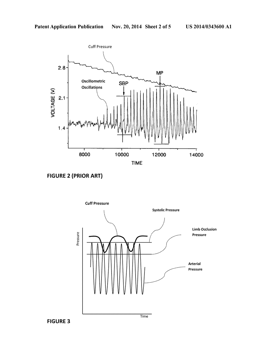 MULTI-MODE INFLATABLE LIMB OCCLUSION DEVICE - diagram, schematic, and image 03