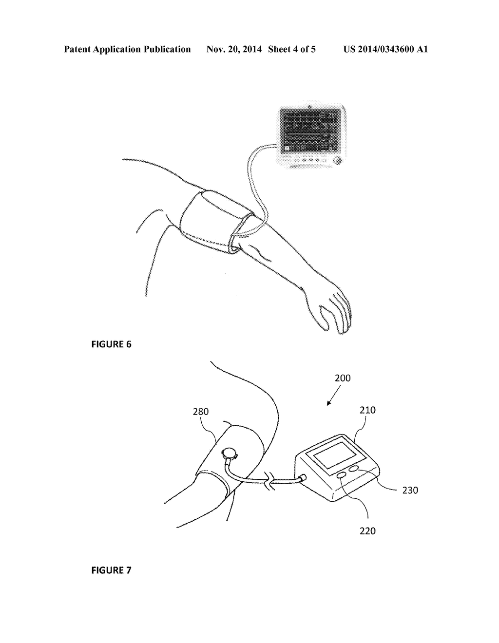 MULTI-MODE INFLATABLE LIMB OCCLUSION DEVICE - diagram, schematic, and image 05