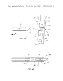 CLIP-BASED SYSTEMS AND METHODS FOR TREATING SEPTAL DEFECTS diagram and image