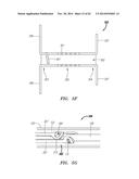 CLIP-BASED SYSTEMS AND METHODS FOR TREATING SEPTAL DEFECTS diagram and image